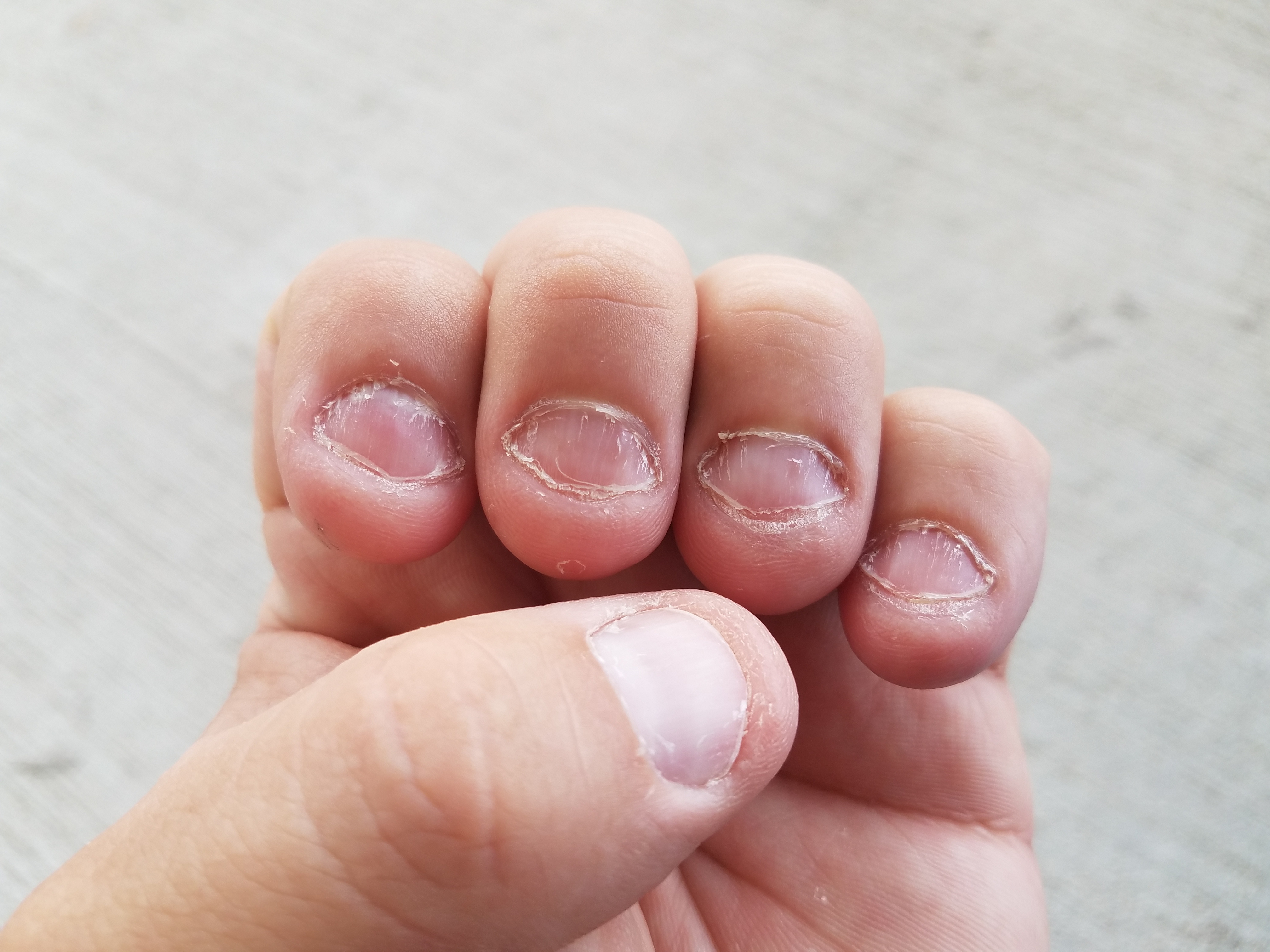 Детский маникюр на обгрызанные ногти (49 фото)