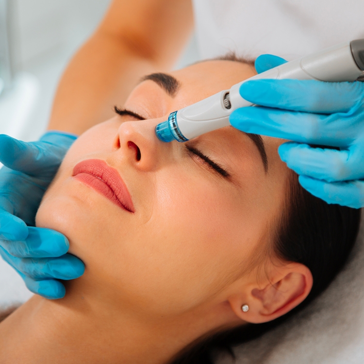 Вакуумный гидропилинг HYDRAFACIAL