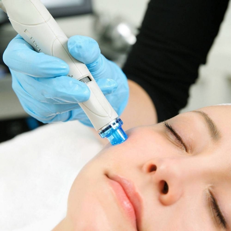 Алмазная микродермабразия HYDRAFACIAL