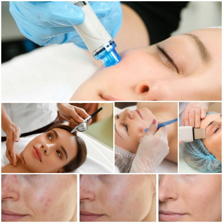 Вакуумный гидропилинг HYDRAFACIAL