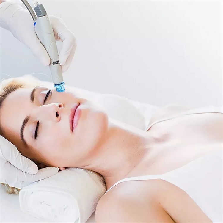 HYDRAFACIAL эксфолиация
