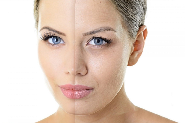 Аппарат Picosure cynosure