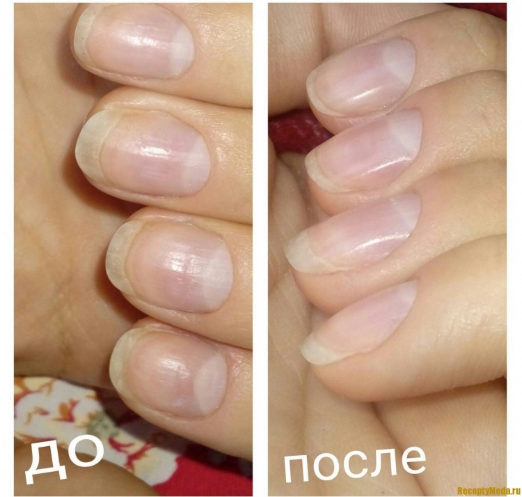 Запечатывание ногтей воском