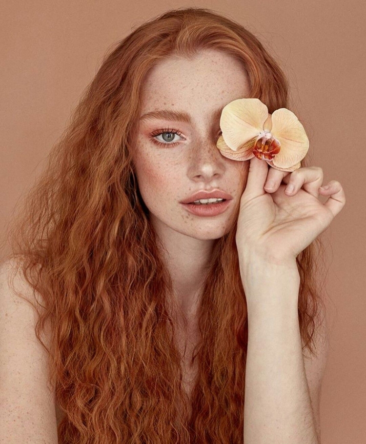 Riley Rasmussen Freckles