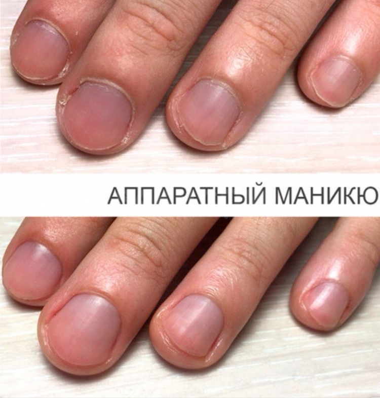 Ногтевая пластина у мужчин
