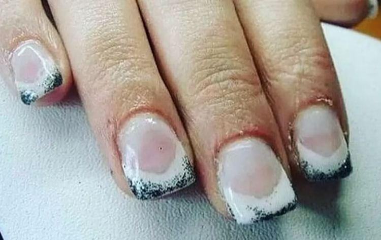 Неудачное наращивание ногтей