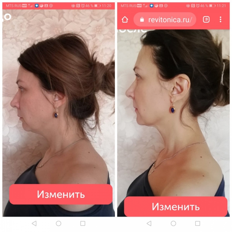 Ревитоника для шеи и осанки