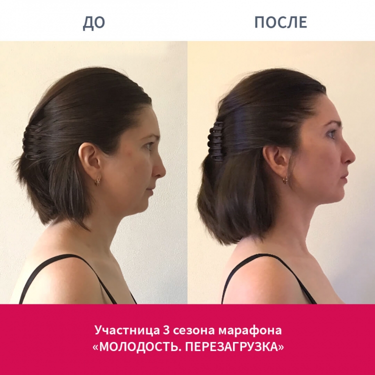Ревитоника молодость до и после